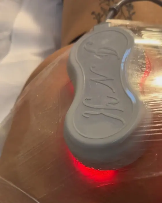 Trattamento corpo con manipolo luminoso