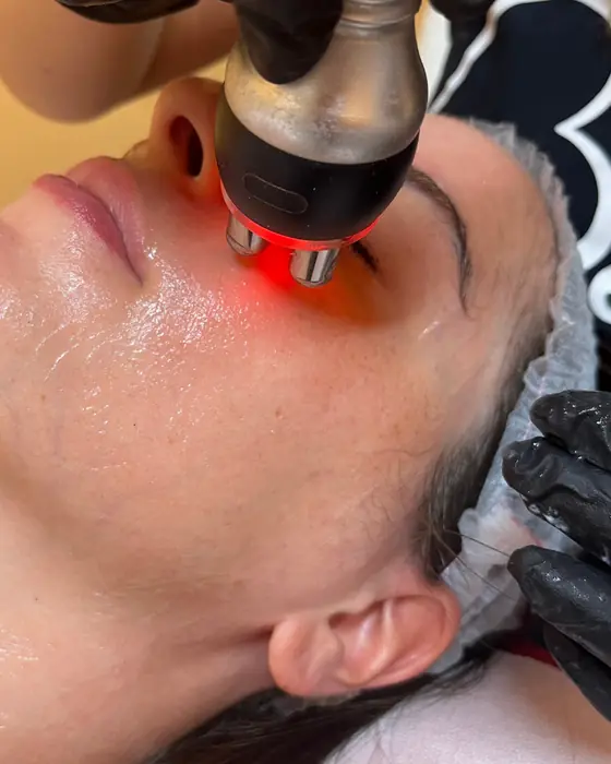 Trattamento viso con luce rossa sulla guancia